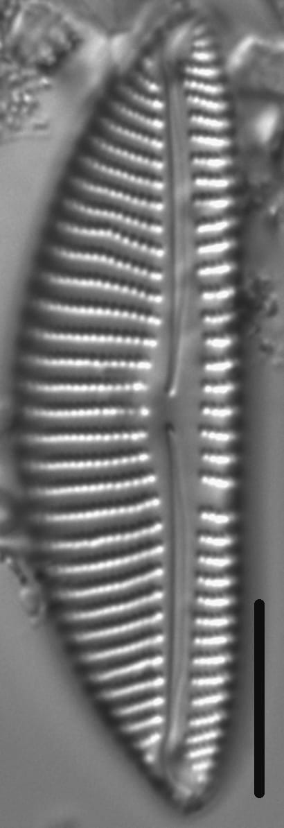 Encyonema vulgare LM4