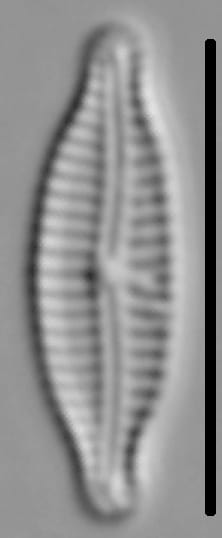 Encyonemopsis Microcephala 005