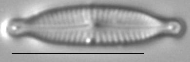 Encyonopsis Alpina 4