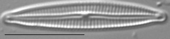 Encyonopsis Anaconda1