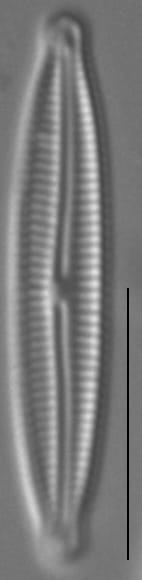 Encyonopsis Anaconda2