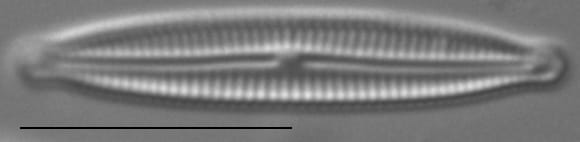 Encyonopsis Anaconda2