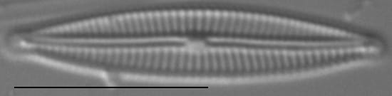 Encyonopsis Anaconda4