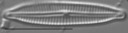 Encyonopsis Anaconda5