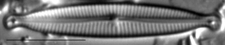 Encyonopsis Czarneckii 3