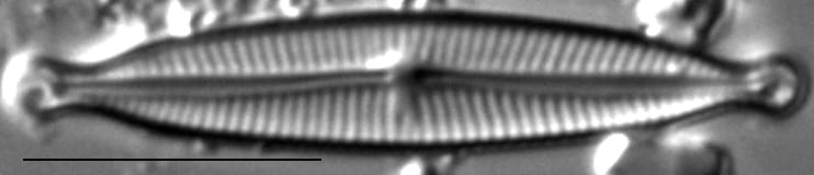 Encyonopsis Czarneckii 4