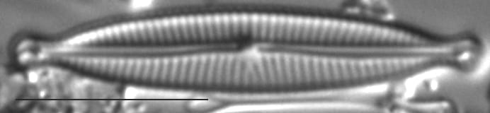 Encyonopsis Czarneckii 6