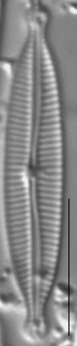 Encyonopsis Czarneckii 7