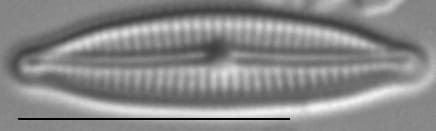 Encyonopsis Krammeri 6