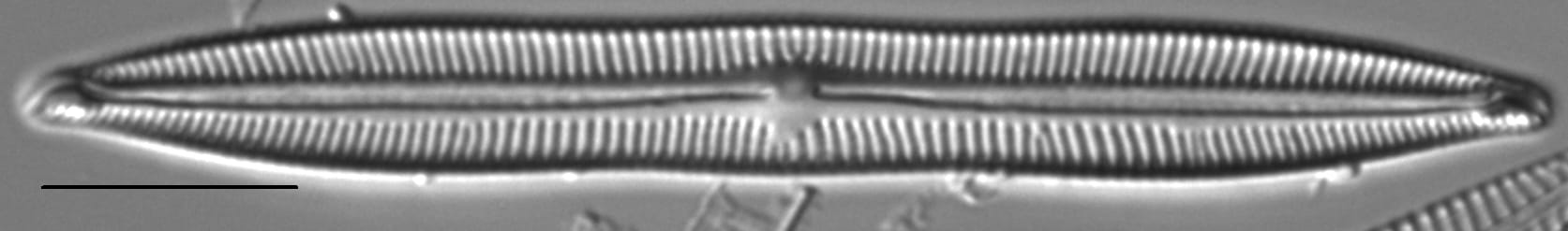 Encyonopsis Lacuscaeruleus 1