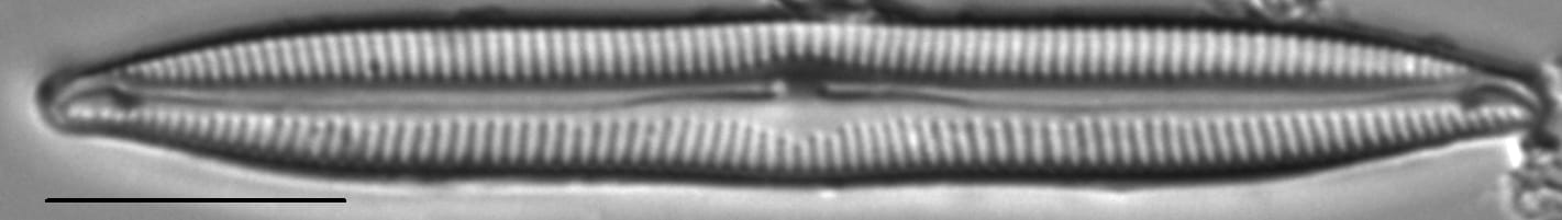 Encyonopsis Lacuscaeruleus 2