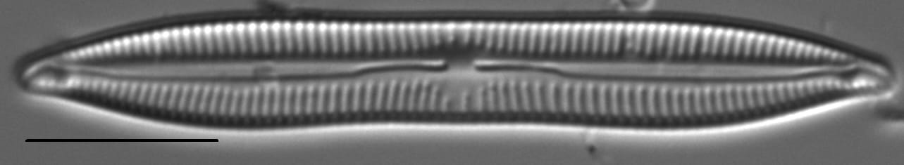 Encyonopsis Lacuscaeruleus 4