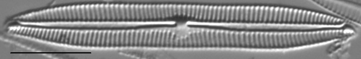 Encyonopsis Lacuscaeruleus 5