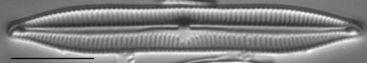 Encyonopsis Lacuscaeruleus 6