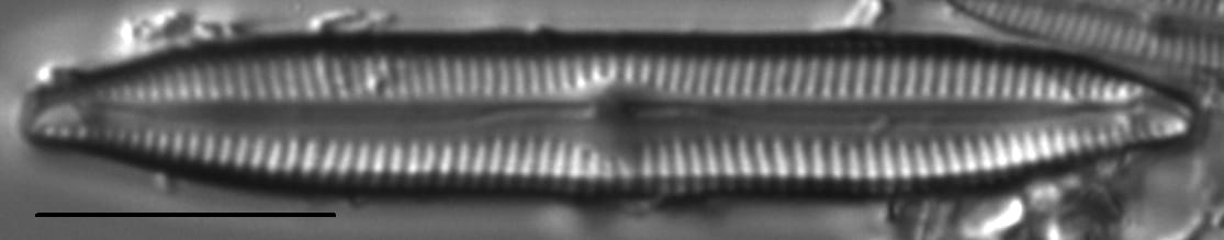 Encyonopsis Lacuscaeruleus 7