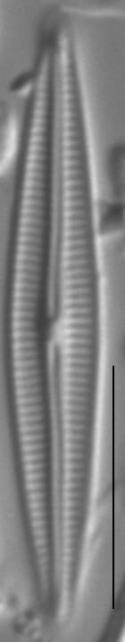 Encyonopsis Montana0