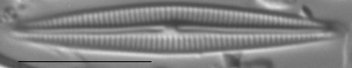 Encyonopsis Montana0