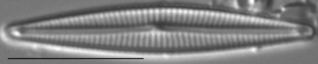 Encyonopsis Montana1