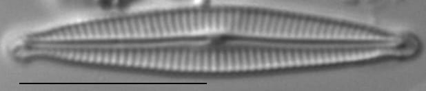 Encyonopsis Montana2