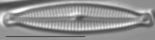 Encyonopsis Montana4