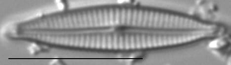 Encyonopsis Montana5
