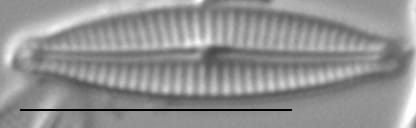 Encyonopsis Montana6