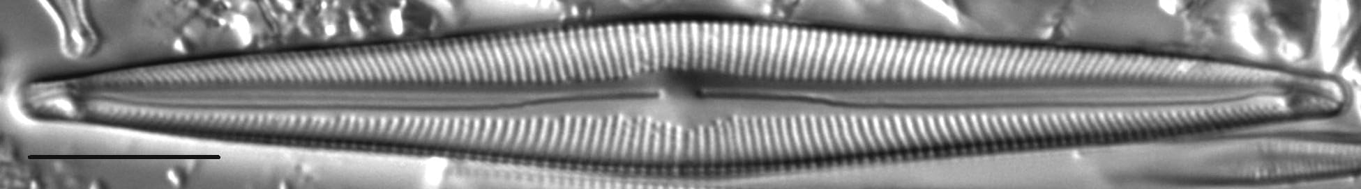 Encyonopsis Montana 1