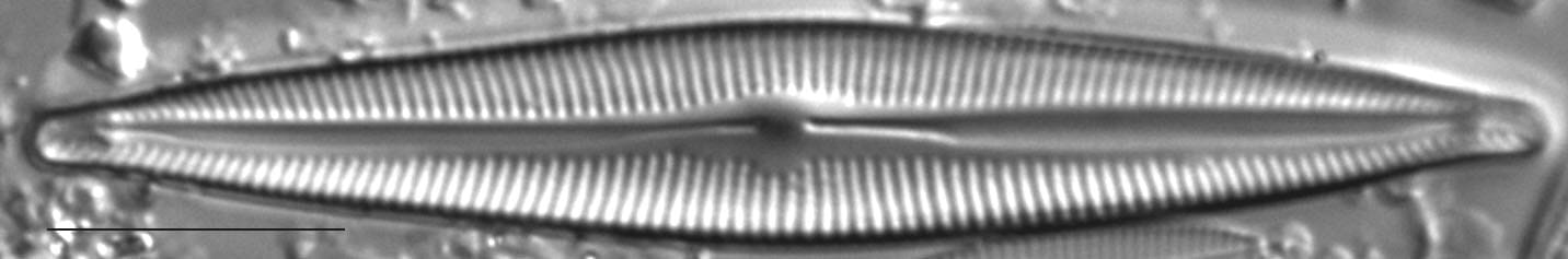 Encyonopsis Montana 3