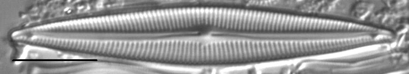 Encyonopsis Montana 4