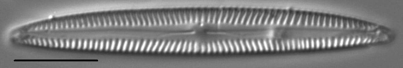 Encyonopsis Neoamphioxys 2