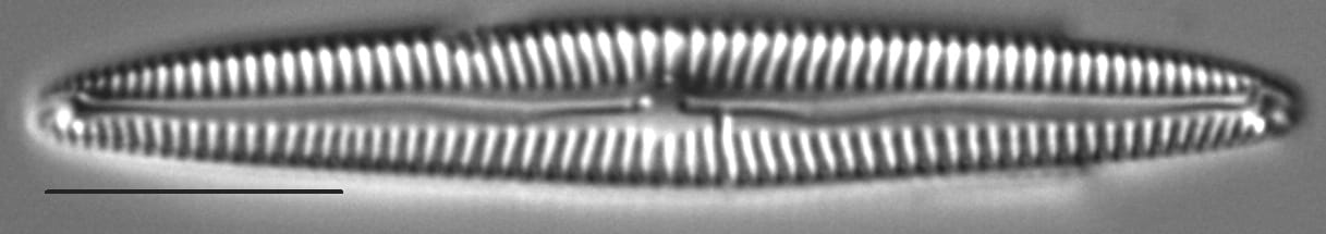 Encyonopsis Neoamphioxys 5