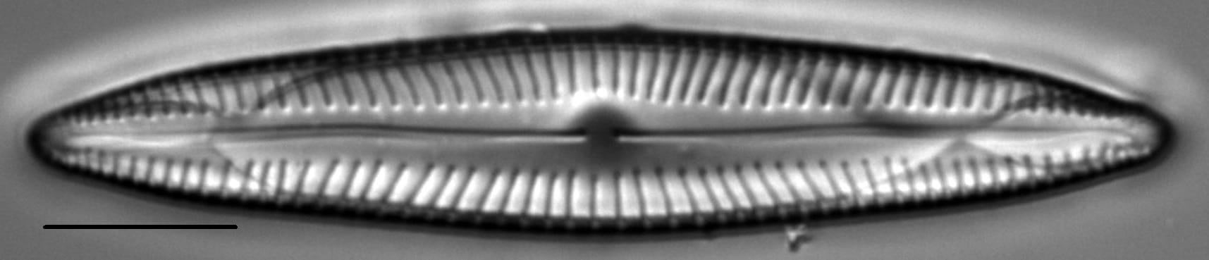 Encyonopsis Stodderi 3