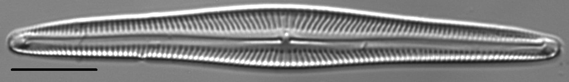 Encyonopsis Subspicula1