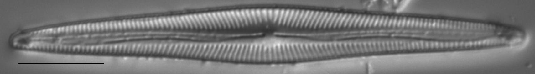 Encyonopsis Subspicula2