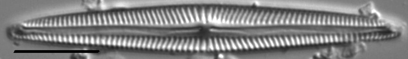 Encyonopsis Subspicula6