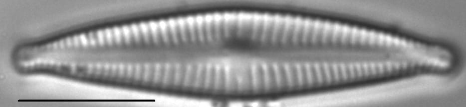 Encyonopsisaequaliformis2