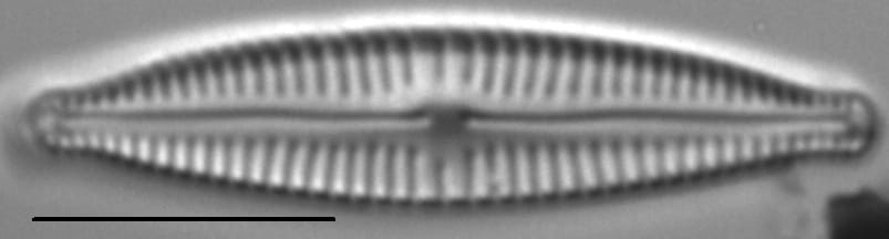 Encyonopsisaequaliformis3