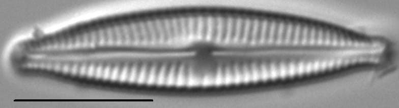 Encyonopsisaequaliformis4