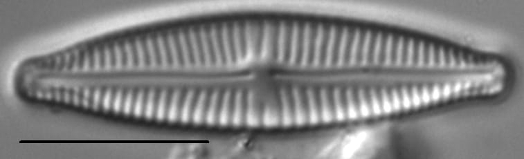 Encyonopsisaequaliformis5