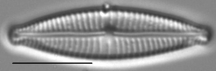 Encyonopsisaequaliformis6