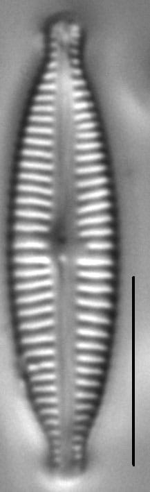 Encyonopsisaequalis 7