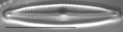 Encyonopsiskutenai 6