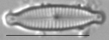 Encyonopsislacusalpinus2