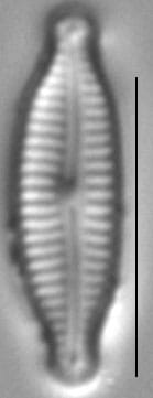 Encyonopsis microcephala sensu Krammer LM3