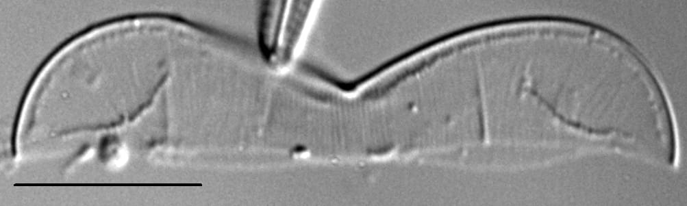 Entomoneis punctulata LM2