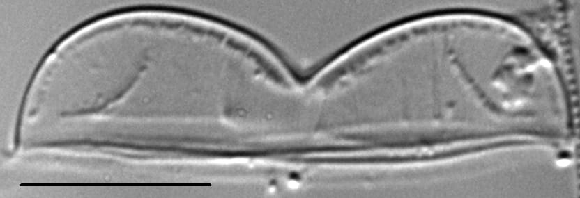 Entomoneis punctulata LM5