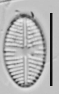 Eolimna Aboensis Me10009 B 101317 62