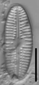 Eolimna metafarta LM1