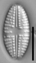 Eolimna metafarta LM5