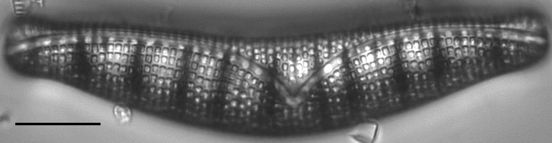 Epithemia Alpestris  Ill2017 03